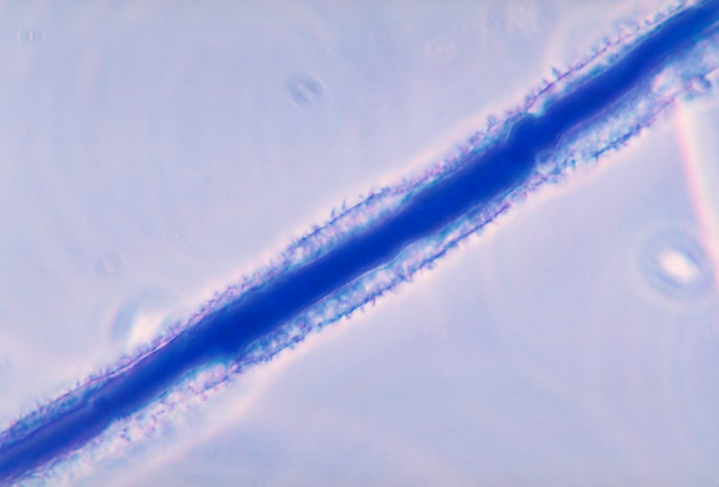 Aflatoxin mould